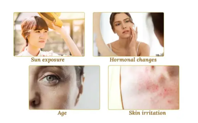 What Factors Darken Skin